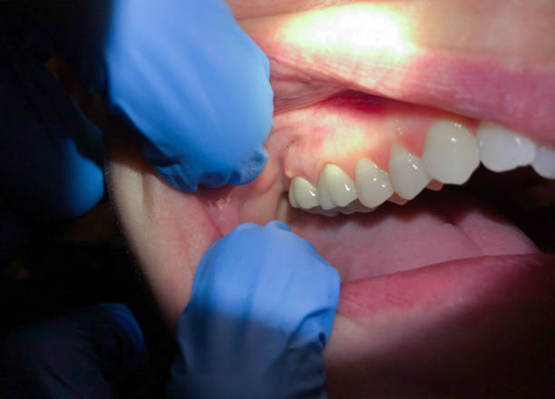 Best Same-Day Emergency Dentist in Mount Carmel, TN